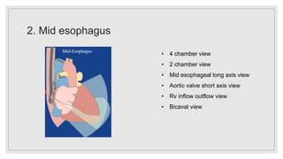Cardiovascular monitoring final ppt.pptx