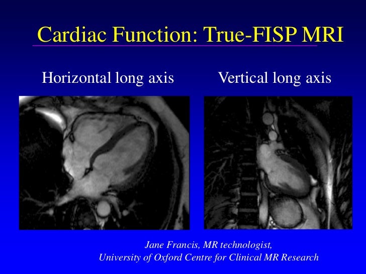 Cardiac MRI