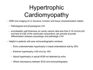 Hypertrophic
Cardiomyopathy
• CMR cine imaging of LV structure, function and tissue characterisation helpful
• Pathological and physiological LVH
• end-diastolic wall thickness–to–cavity volume ratio less than 0.15 mm/mL/m2
and lack of LGE of the ventricular myocardium can provide accurate
differentiation between physiologic and pathologic LVH
• Helpful in patients with poor echocardiographic windows
• Echo underestimates hypertrophy in basal anterolateral wall by 20%
• Extreme hypertrophy (>30 mm) by 10%
• Apical hypertrophy in apical HCM not detected by echo
• Where discrepancy between ECG and echocardiography
 