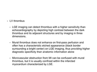 • LV thrombus
• LGE imaging can detect thrombus with a higher sensitivity than
echocardiography by depicting high contrast between the dark
thrombus and its adjacent structures and by imaging in three
dimensions.
• Mural thrombus does not enhance on first-pass perfusion and
often has a characteristic etched appearance (black border
surrounding a bright center) on LGE imaging, thus providing higher
diagnostic specificity than anatomic information alone
• Microvascular obstruction from MI can be confused with mural
thrombus, but it is usually confined within the infarcted
myocardium characterized by LGE.
 