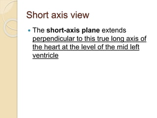 Short axis view
 The short-axis plane extends
perpendicular to this true long axis of
the heart at the level of the mid left
ventricle
 