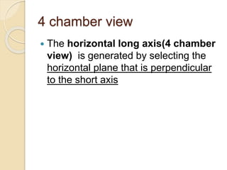 4 chamber view
 The horizontal long axis(4 chamber
view) is generated by selecting the
horizontal plane that is perpendicular
to the short axis
 