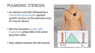 PULMONIC STENOSIS
• An ejection click (EC) followed by a
crescendo-decrescendo ejection
systolic murmur at the pulmonic area,
EC may be absent
• Murmur becomes louder with
inspiration unlike ESM of AS which
becomes softer
• May radiate towards the left clavicle
 