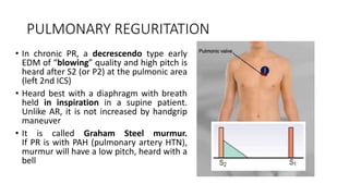 PULMONARY REGURITATION
• In chronic PR, a decrescendo type early
EDM of “blowing” quality and high pitch is
heard after S2 (or P2) at the pulmonic area
(left 2nd ICS)
• Heard best with a diaphragm with breath
held in inspiration in a supine patient.
Unlike AR, it is not increased by handgrip
maneuver
• It is called Graham Steel murmur.
If PR is with PAH (pulmonary artery HTN),
murmur will have a low pitch, heard with a
bell
 
