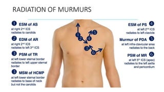 RADIATION OF MURMURS
 