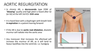 AORTIC REGURGITATION
• In chronic AR, a decrescendo type EDM of
“blowing” quality and high pitch is heard after S2
(or A2) at the left 3rd ICS- Erb’s area
• It is heard best with a diaphragm with breath held
in expiration in a patient leaning forward
• If the AR is due to aortic root dilatation, diastolic
murmur will radiate into the aortic area
• Any maneuver that increases the afterload will
increase the murmur of AR, as it will tend to
favour backflow into the ventricle. i.e. handgrip
 