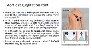 Aortic regurgitation cont…
• There can also be a mid-systolic murmur with AR,
due to the increased flow across the aortic valve
during systole
• In AR, a third murmur may be heard, called Austin-
Flint murmur, which is a soft mid-to-late diastolic
murmur of low pitch and “rumbling” quality. It is
heard at the apex, best with a bell during expiration
• It is thought to be due to functional mitral valve
stenosis, as backflow jet from aorta presses on the
anterior mitral leaflet to slightly occlude the blood
flow from LA into LV during diastole
• Rarely, an early diastolic murmur, called Cole-Cecil
murmur, may be heard in axilla
 