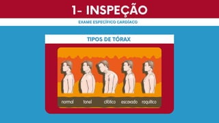 1- INSPEÇÃO
1- INSPEÇÃO
EXAME ESPECÍFICO CARDÍACO
EXAME ESPECÍFICO CARDÍACO
TIPOS DE TÓRAX
TIPOS DE TÓRAX
 