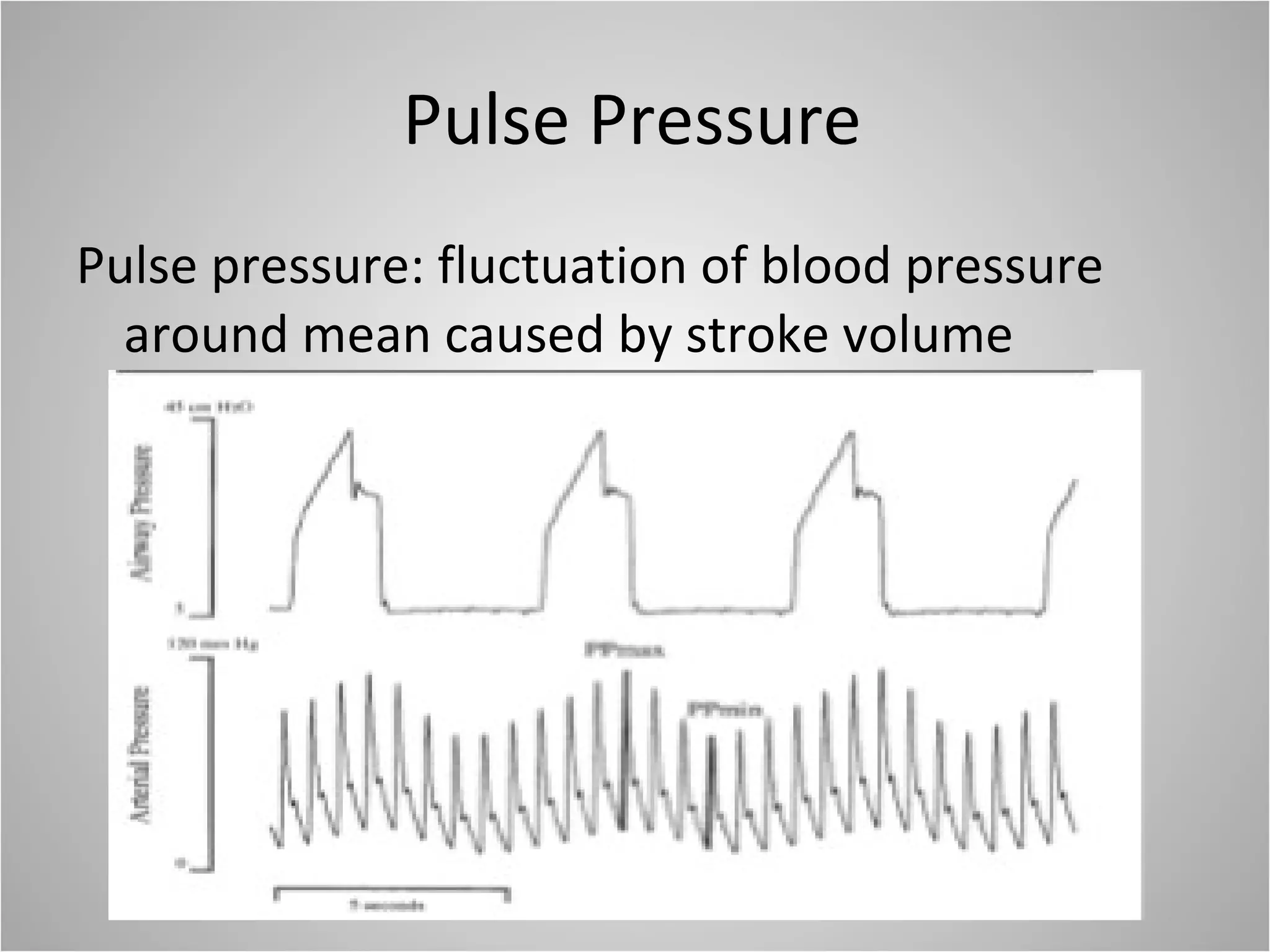 Pulse Pressure Pulse pressure: fluctuation of blood pressure around mean caused by stroke volume 