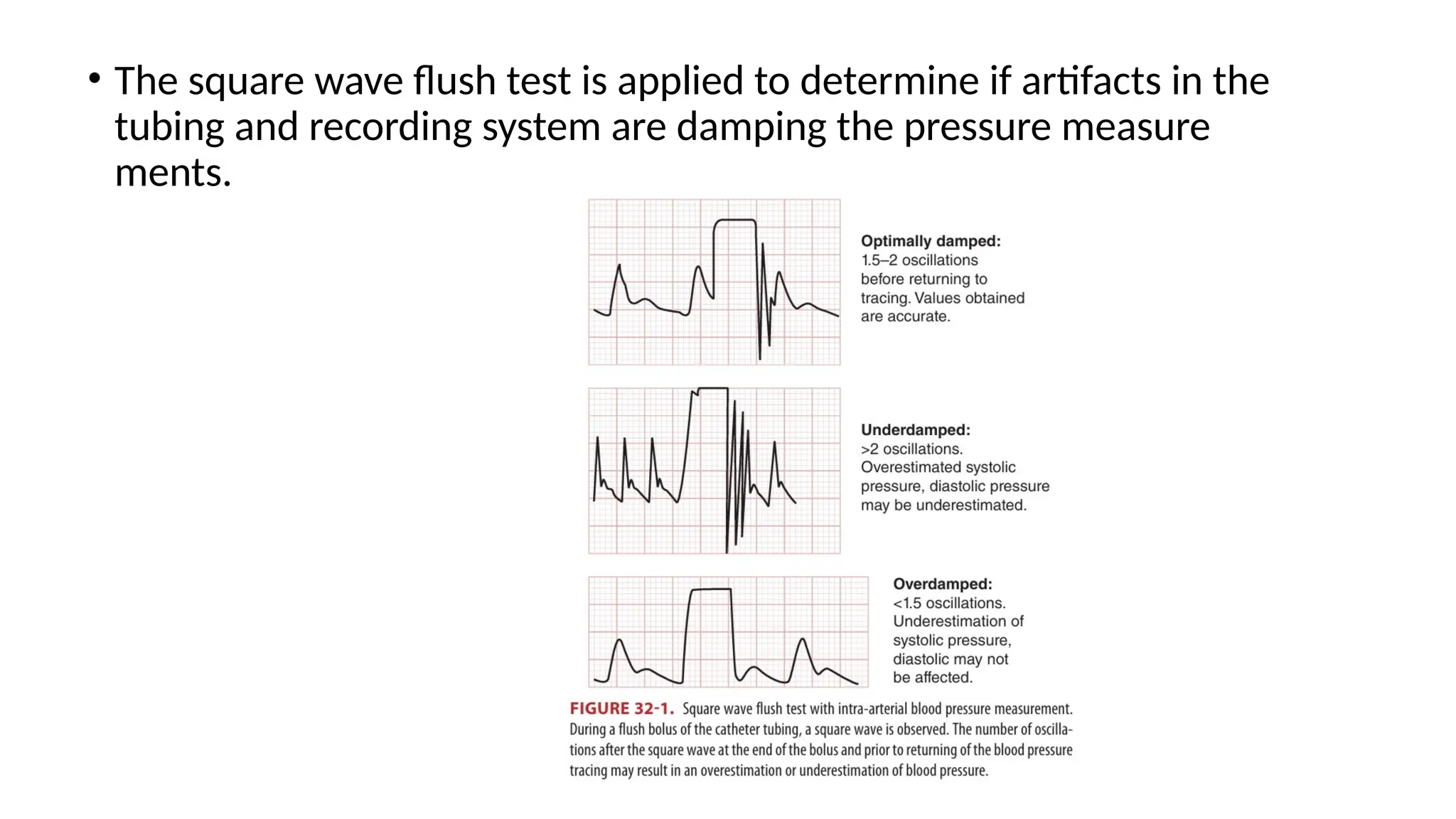 • The square wave flush test is applied to determine if artifacts in the
tubing and recording system are damping the pressure measure
ments.
 