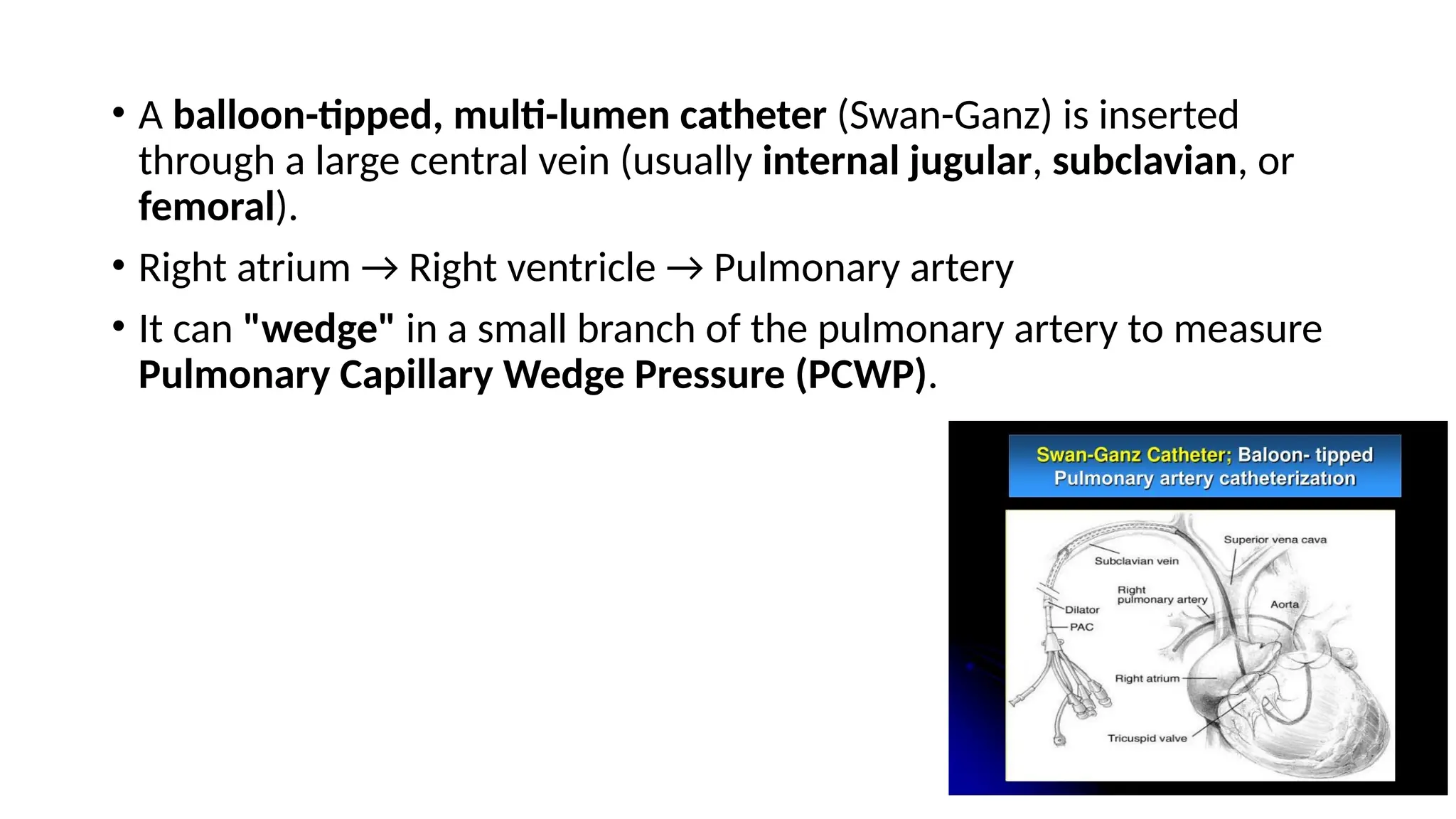 • A balloon-tipped, multi-lumen catheter (Swan-Ganz) is inserted
through a large central vein (usually internal jugular, subclavian, or
femoral).
• Right atrium → Right ventricle → Pulmonary artery
• It can "wedge" in a small branch of the pulmonary artery to measure
Pulmonary Capillary Wedge Pressure (PCWP).
 