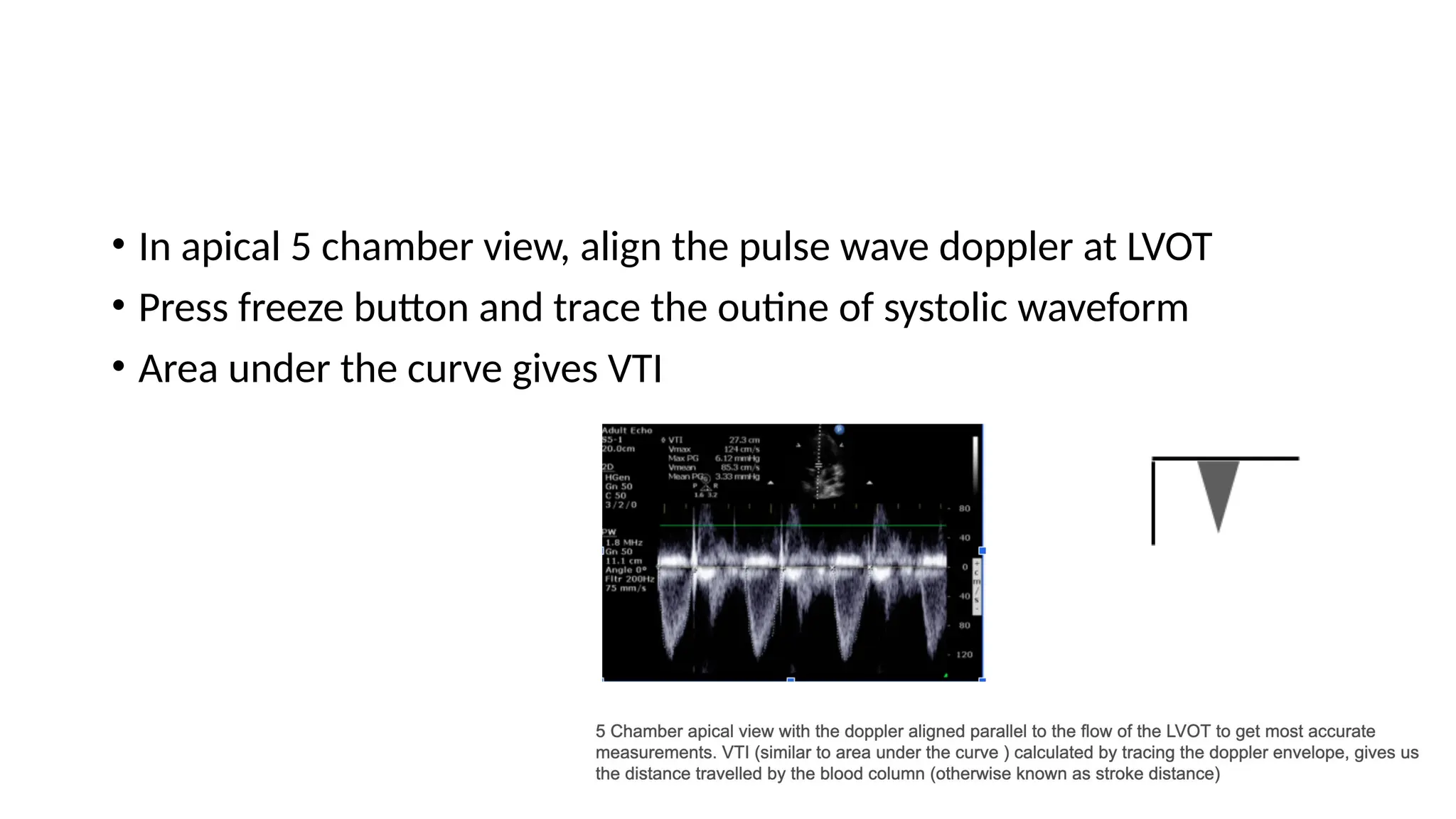 • In apical 5 chamber view, align the pulse wave doppler at LVOT
• Press freeze button and trace the outine of systolic waveform
• Area under the curve gives VTI
 