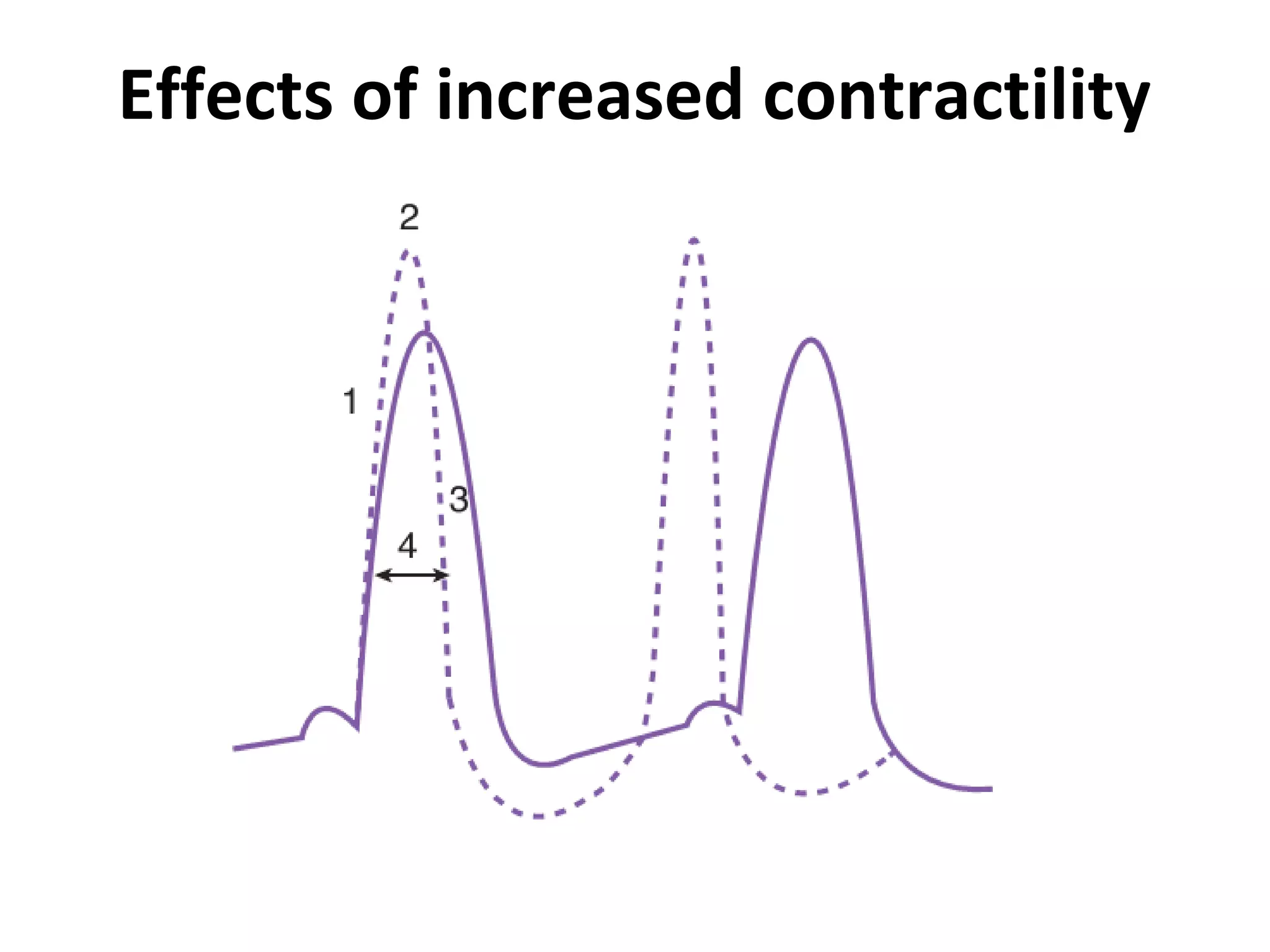 Effects of increased contractility
 