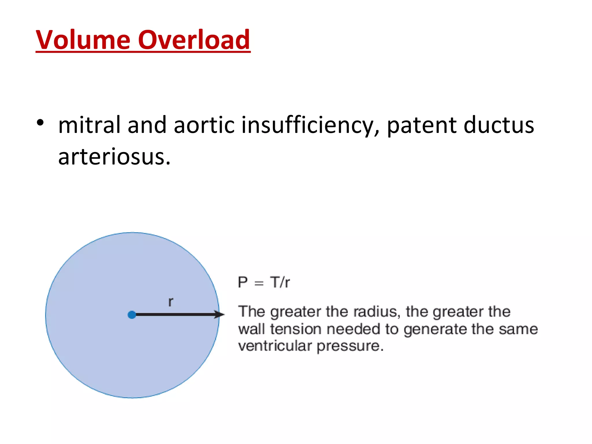 Volume Overload
• mitral and aortic insufficiency, patent ductus
arteriosus.
 
