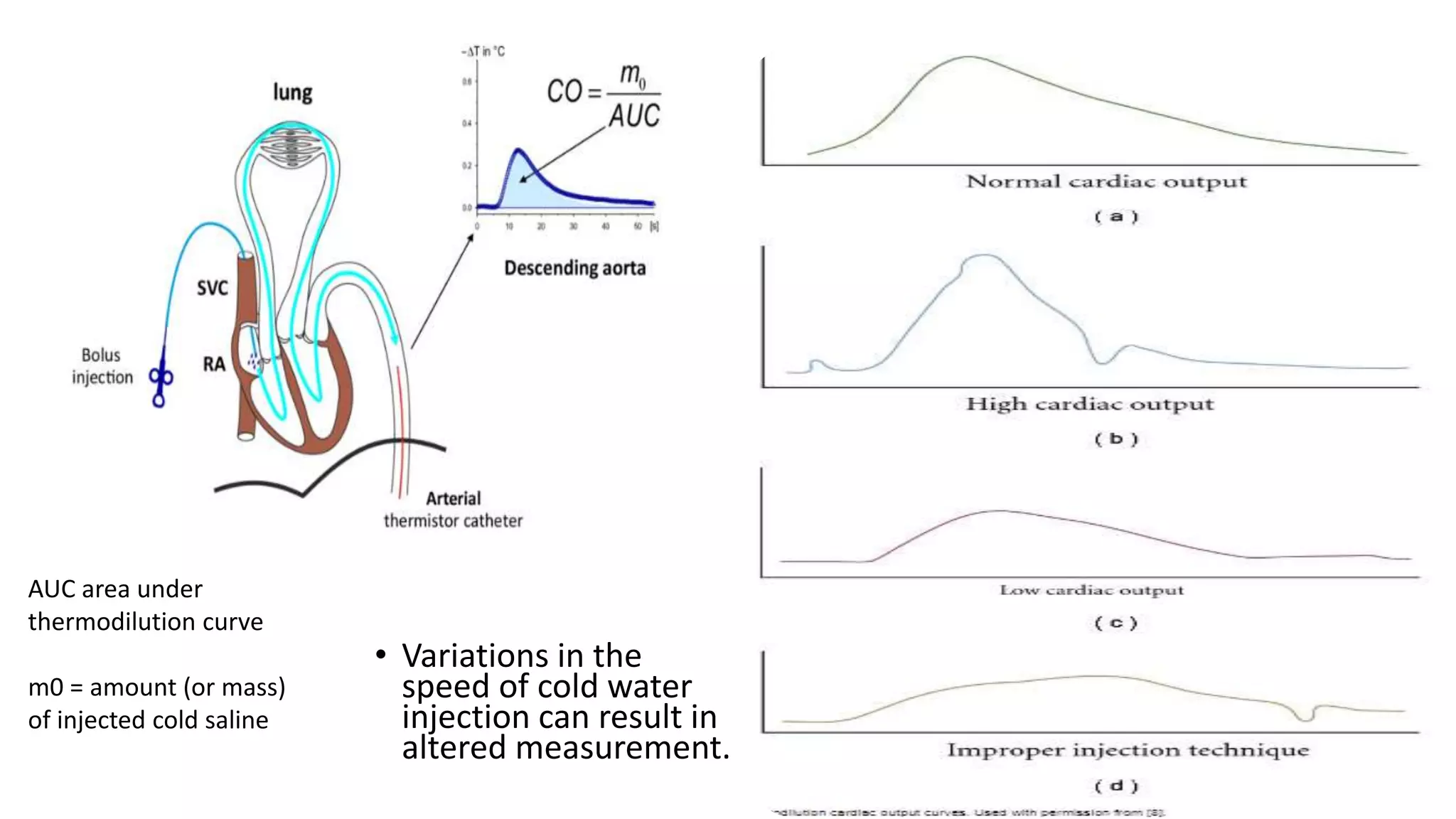 cardiac output pptx | PPTX