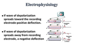 Electrophysiology
◼ If wave of depolarization
spreads toward the recording
electrode-positive deflection.
◼ If wave of depolarization
spreads away from recording
electrode, a negative deflection
 