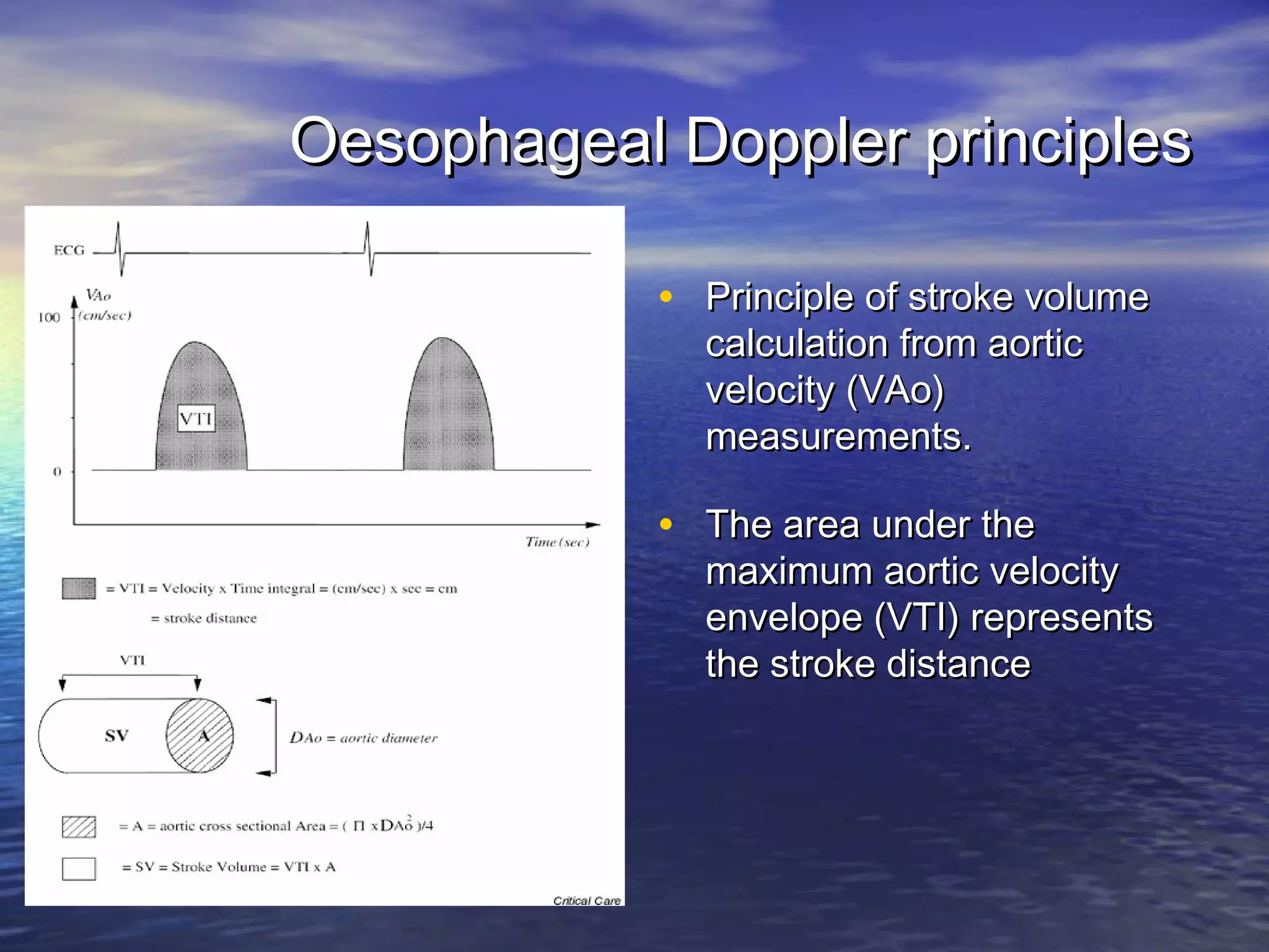 Oesophageal Doppler principles

            • Principle of stroke volume
              calculation from aortic
              velocity (VAo)
              measurements.

            • The area under the
              maximum aortic velocity
              envelope (VTI) represents
              the stroke distance
 