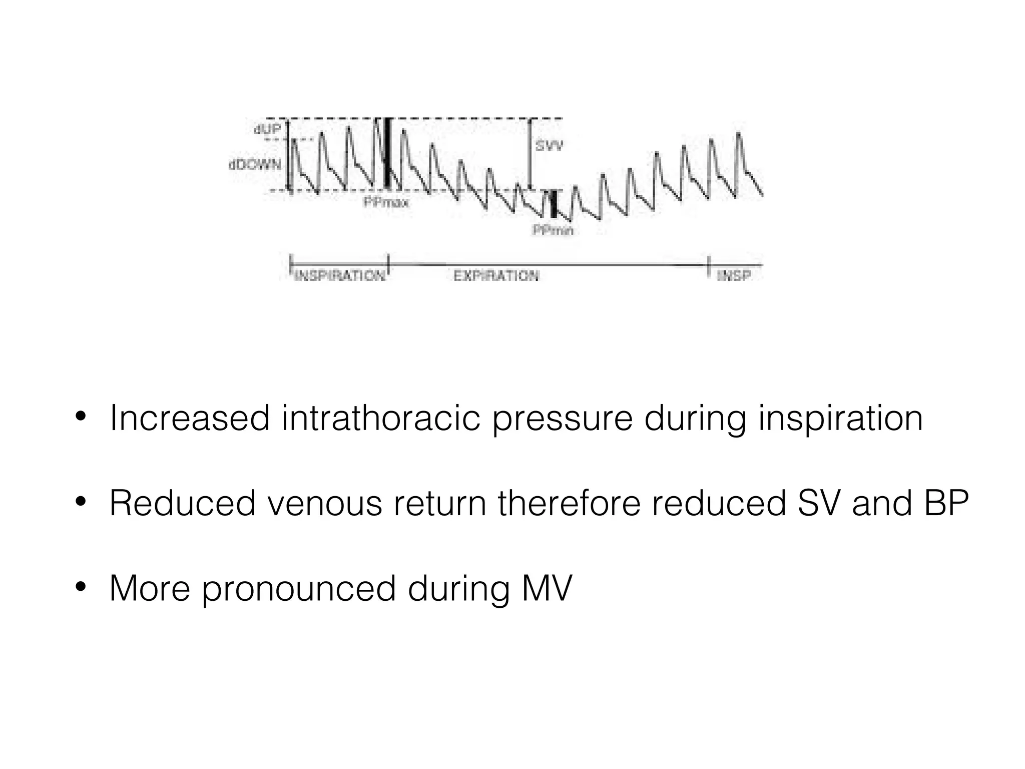 •

Increased intrathoracic pressure during inspiration

•

Reduced venous return therefore reduced SV and BP

•

More pronounced during MV

 