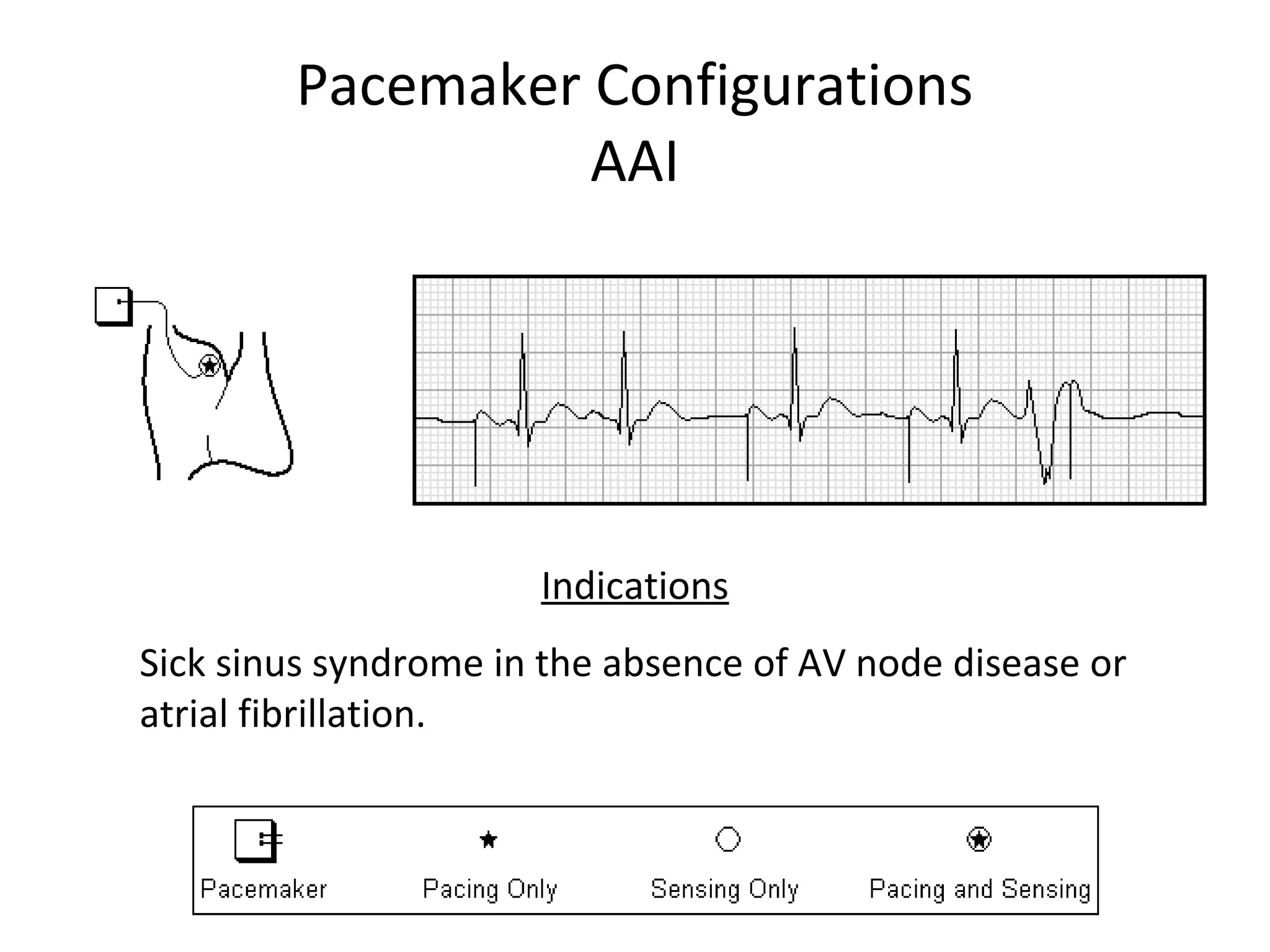 Pacemaker Configurations
AAI
Indications
Sick sinus syndrome in the absence of AV node disease or
atrial fibrillation.
 
