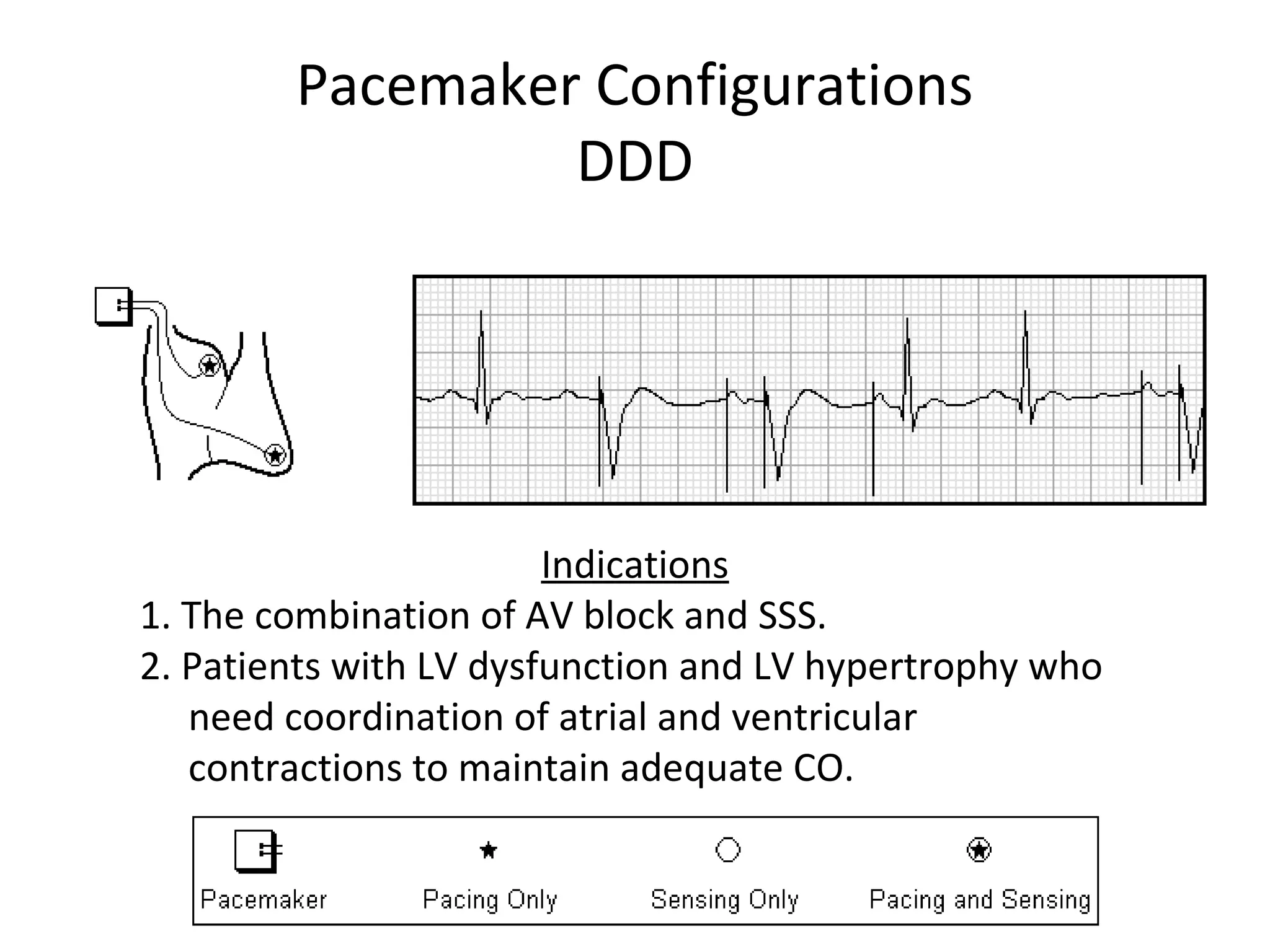 Pacemaker Configurations
DDD
Indications
1. The combination of AV block and SSS.
2. Patients with LV dysfunction and LV hypertrophy who
need coordination of atrial and ventricular
contractions to maintain adequate CO.
 