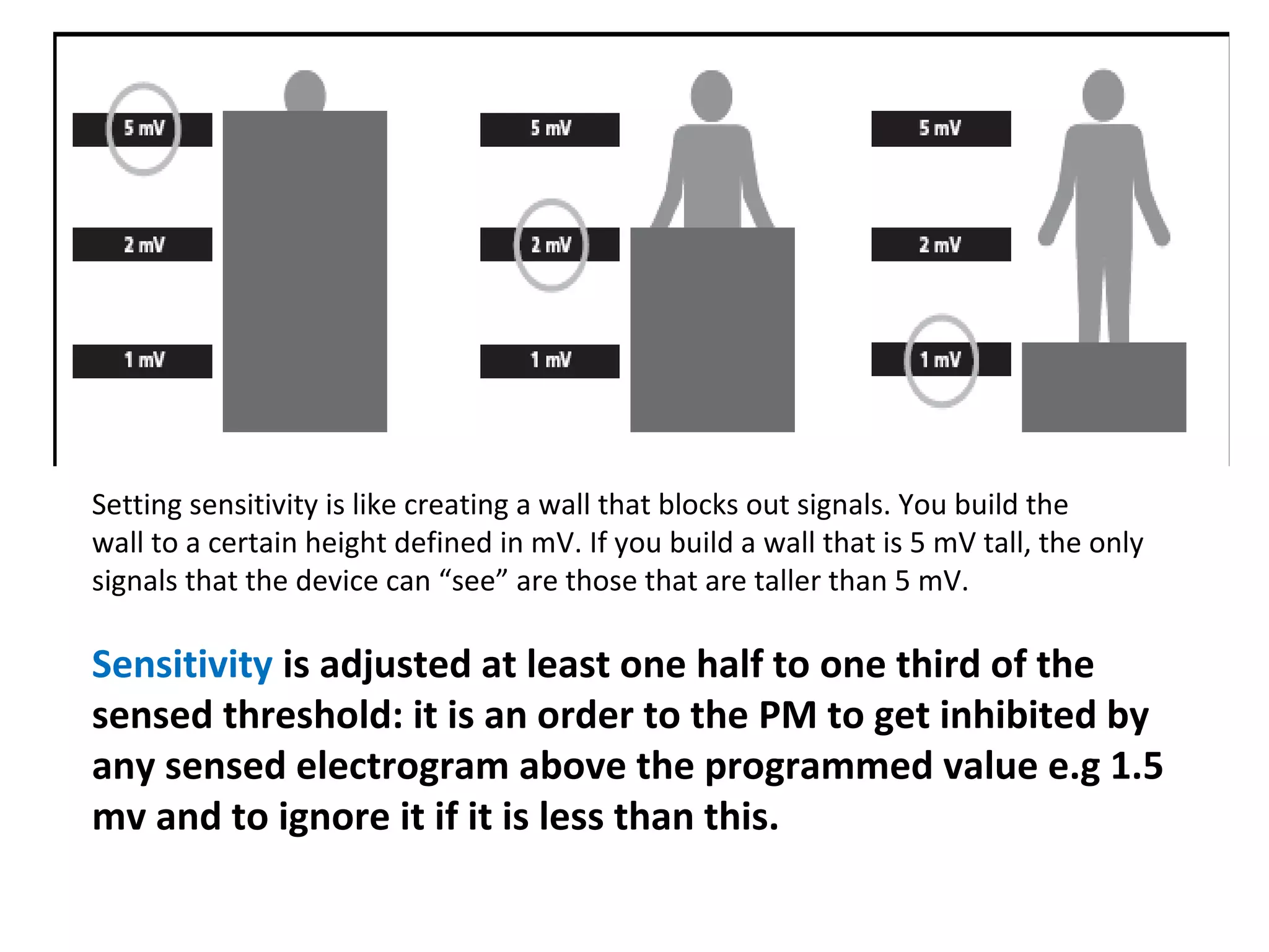 Setting sensitivity is like creating a wall that blocks out signals. You build the
wall to a certain height defined in mV. If you build a wall that is 5 mV tall, the only
signals that the device can “see” are those that are taller than 5 mV.
Sensitivity is adjusted at least one half to one third of the
sensed threshold: it is an order to the PM to get inhibited by
any sensed electrogram above the programmed value e.g 1.5
mv and to ignore it if it is less than this.
 
