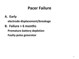 17
Pacer Failure
A. Early
electrode displacement/breakage
B. Failure > 6 months
Premature battery depletion
Faulty pulse generator
 