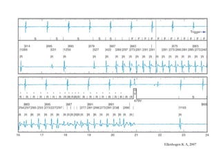 Ellenbogen K A, 2007Ellenbogen K A, 2007
 