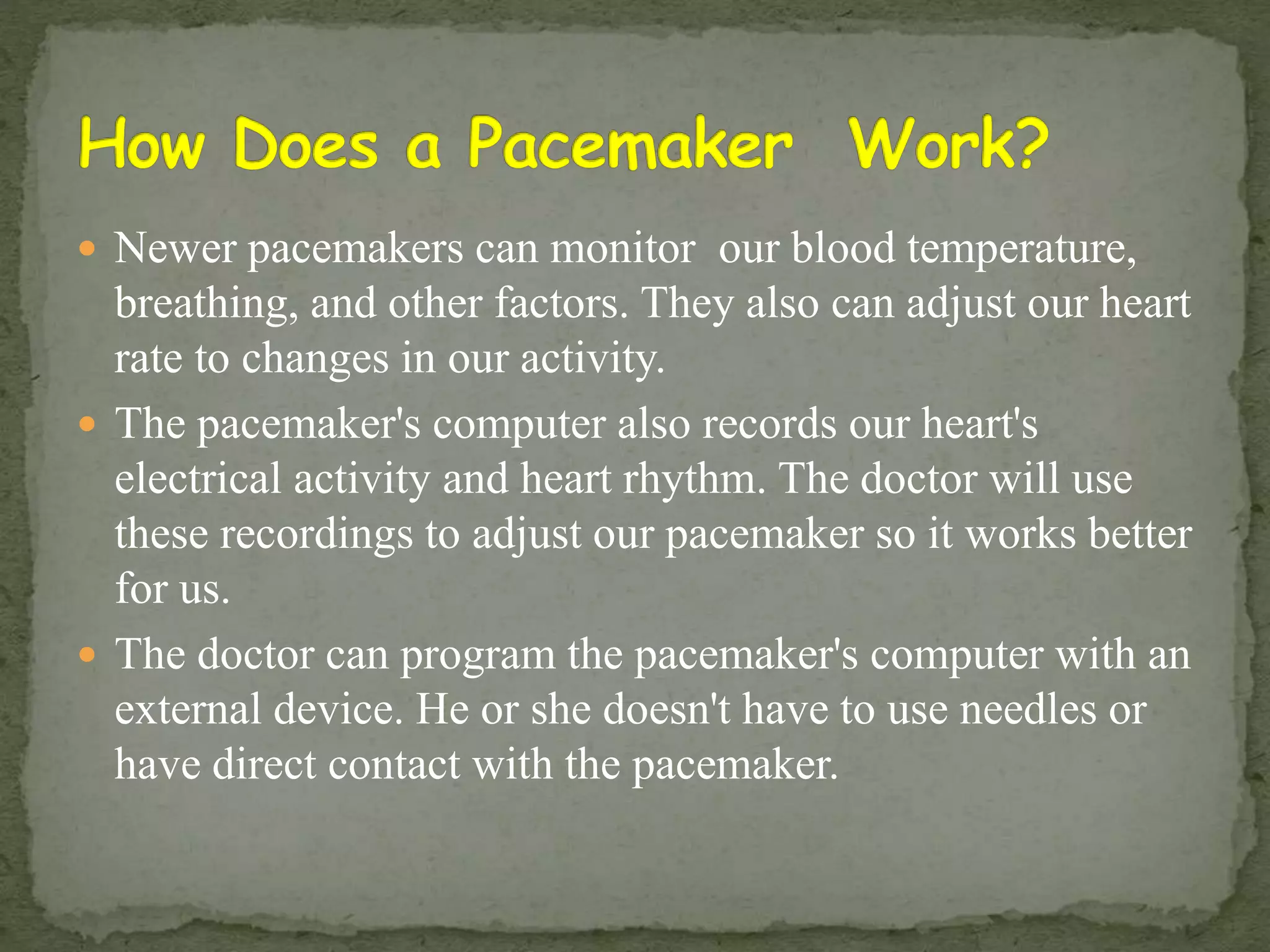 Cardiac pacemaker | PPTX