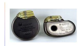Artificial Cardiac pacemaker |medical device that generates electrical ...