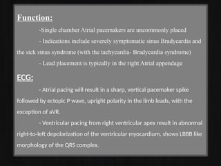 Function:
-Single chamber Atrial pacemakers are uncommonly placed
- Indications include severely symptomatic sinus Bradycardia and
the sick sinus syndrome (with the tachycardia- Bradycardia syndrome)
- Lead placement is typically in the right Atrial appendage
ECG:
- Atrial pacing will result in a sharp, vertical pacemaker spike
followed by ectopic P wave, upright polarity in the limb leads, with the
exception of aVR.
- Ventricular pacing from right ventricular apex result in abnormal
right-to-left depolarization of the ventricular myocardium, shows LBBB like
morphology of the QRS complex.
 