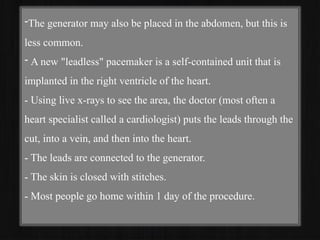 -The generator may also be placed in the abdomen, but this is
less common.
- A new "leadless" pacemaker is a self-contained unit that is
implanted in the right ventricle of the heart.
- Using live x-rays to see the area, the doctor (most often a
heart specialist called a cardiologist) puts the leads through the
cut, into a vein, and then into the heart.
- The leads are connected to the generator.
- The skin is closed with stitches.
- Most people go home within 1 day of the procedure.
 