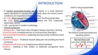 CARDIAC PACEMAKERS_by biotech students.pptx