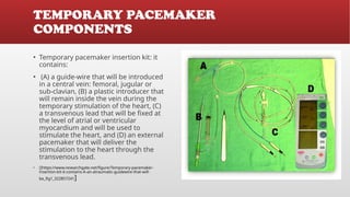 Cardiac Pacemaker , Types of Pacemaker and its Usages | PPTX