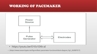 Placemaker Types Cardiac Pacemaker , Types of Pacemaker and its Usages | PPTX
