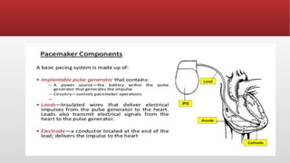 Placemaker Types Cardiac Pacemaker , Types of Pacemaker and its Usages | PPTX