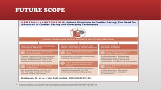 Placemaker Types Cardiac Pacemaker , Types of Pacemaker and its Usages | PPTX