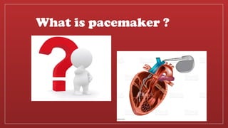 Placemaker Types Cardiac Pacemaker , Types of Pacemaker and its Usages | PPTX