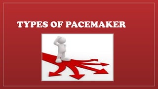 Placemaker Types Cardiac Pacemaker , Types of Pacemaker and its Usages | PPTX