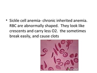 • Sickle cell anemia- chronic inherited anemia.
RBC are abnormally shaped. They look like
crescents and carry less O2. the sometimes
break easily, and cause clots

 