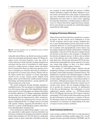1217 Ischemic Heart Disease
vulnerable arterial ﬁbrous cap, thereby increasing circumfer-
ential stress potentially precipitating rupture [9]. Plaque dis-
ruption occurs with great frequency; some may result in
cardiac infarction or death. Episodes of plaque disruption are
associated with the onset or exacerbation of stable angina,
caused by a sudden increase in plaque volume and diminu-
tion of coronary ﬂow. However, many minor episodes of ero-
sions or disruption are clinically silent and yet contribute to
the progression of coronary artery disease. Patients with sta-
ble angina usually have segments of chronic high-degree
stenosis in one, or more, coronary arteries. Rupture of the
plaque surface can be followed by variable amounts of plaque
hemorrhage and luminal thrombosis, causing rapid but sub-
clinical progression of the lesion.
The second mechanism favoring thrombus formation is
endothelial erosion. This may progress to endothelial denuda-
tion which exposes large areas of the subendothelial compart-
ment connective tissue of the plaque, providing an ideal surface
for thrombus adherence [17]. Plaques undergoing endothelial
erosion contain no speciﬁc feature enabling their detection.
Histologically, they are characterized by a thick, smooth mus-
cle cell–rich ﬁbrous cap, reduced necrotic core area, and a low
degree of inﬂammation (Fig. 7.5). Plaque erosion is associated
with cigarette smoking, suggesting that thrombosis may be
related to a systemic, prothrombogenic pathway rather than a
local, atherothrombotic mechanism [8].
Focal calciﬁcation in atherosclerotic plaques is very com-
mon, particularly in older patients. Coronary thrombosis was
previouslyconsideredtobeetiologicalalsorelatedtoacalciﬁed
nodule with an incidence of 2–6% [18]. However, calciﬁcation
appears to have no direct causal link to thrombosis with only
one exception. In older individuals, the presence of diffuse
intimal calciﬁcation coupled with diffuse dilatation of coro-
nary arteries and intimal tears at the margin of calcium plates
may cause a thrombotic event [19]. Vascular calciﬁcation and
inﬂammation have been shown to rarely coexist, supporting
the notion that calciﬁcation is a healing response to atheroscle-
rosis [11]. Clinical observations suggest that lesions responsi-
ble for acute episodes are generally less calciﬁed than plaques
responsible for stable angina.
Imaging of Coronary Atheroma
Atherosclerosis has historically been considered as a segmen-
tal disease, but this concept can be challenged as at least
20–30% of patients with an acute coronary syndrome have
one or more disrupted plaques present intravascular at ultra-
sound [20]. Moreover, it is well recognized that the coronary
tree of patients with angiographically unseen disease may
haveplaquesathighriskofruptureandthrombosis.Traditional
angiography is insensitive for the detection of plaques that do
not encroach on the lumen as this technique is intended for
the detection of pinpoint stenoses. It allows only an indirect
view of the atheroma and is often unable to detect a poten-
tially fatal lesion. Intravascular ultrasound (IVUS) has dem-
onstrated that angiographically normal segments of an artery
may contain large plaques, as there is no direct relation
between plaque size and the degree of stenosis.
The concept of “vulnerable plaques” indicates that the
morphology of plaque is more clinically more important than
the plaque volume and/or the degree of luminal stenosis. The
identiﬁcation of patients with vulnerable plaques is difﬁcult
and has inspired the development of new methods of in vivo
coronary plaque imaging in hopes of providing methods of
intervention. Although great progress has been made, inva-
sive and noninvasive methods still provide a limited view of
coronary artery disease. The new imaging techniques have
yet to provide the resolution necessary for identiﬁcation
of the thin-cap ﬁbroatheroma. The combination of several
sophisticated imaging methods (i.e., OCT/backscattered
IVUS; IVUS/Raman spectroscopy OCT [optical coherence
tomography]; IVUS [intravascular ultrasound]) may provide
the most information on the presence or absence of disease
[8]. Histology remains the reference method for postmortem
examination as it maximizes the understanding of the clini-
cal aspects of acute coronary syndromes.
Acute Coronary Syndromes
Acute coronary syndrome (ACS) refers to a wide spectrum of
clinical syndromes including unstable angina (UA), non-ST
segment elevation myocardial infarction (NSTEMI), and ST
Fig. 7.5 Coronary thrombus over an endothelial erosion of ﬁbrous
plaque (elastic van Gieson)
 