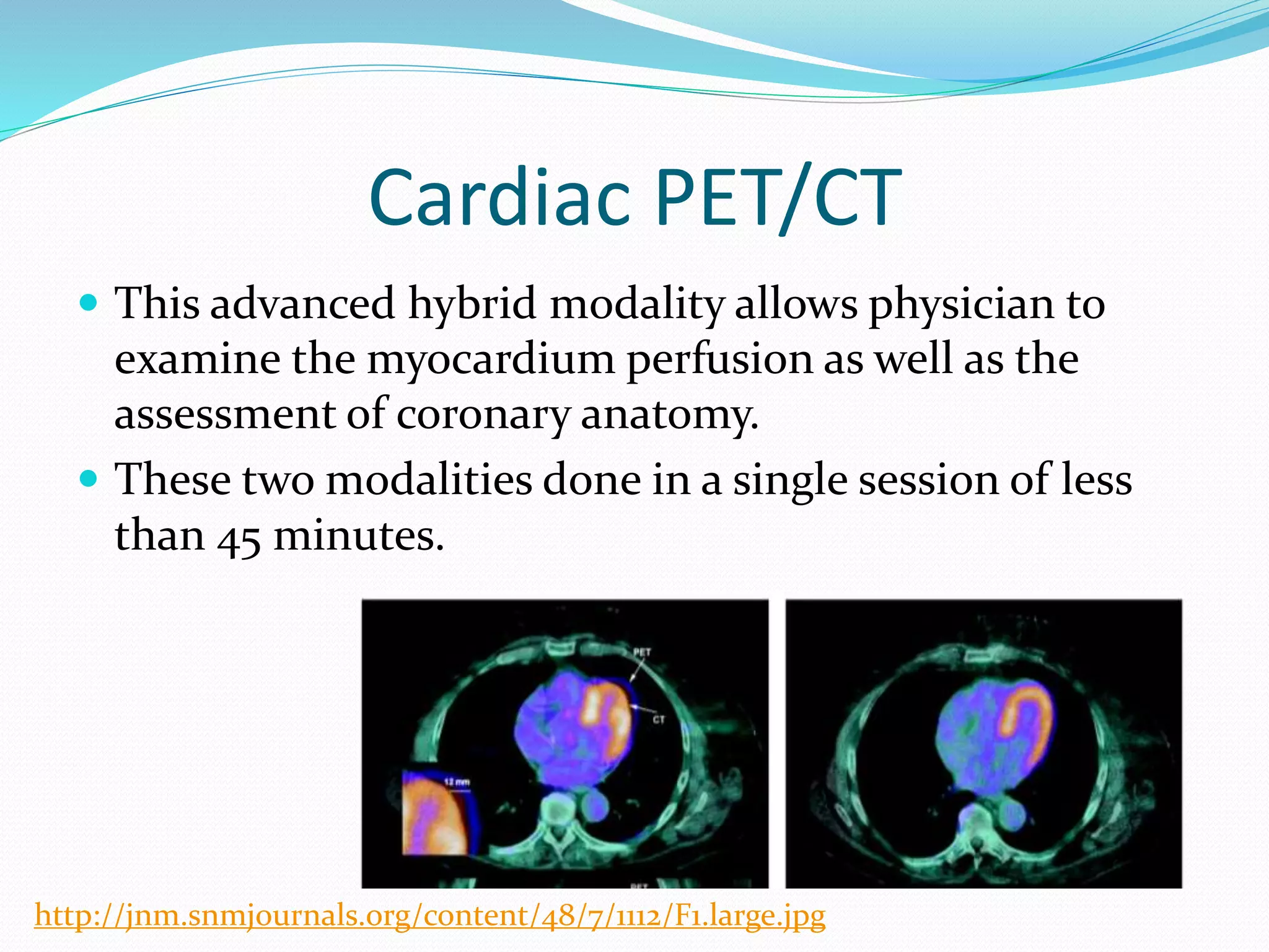 Nuclear Medicine - Cardiac PET/CT | PPTX