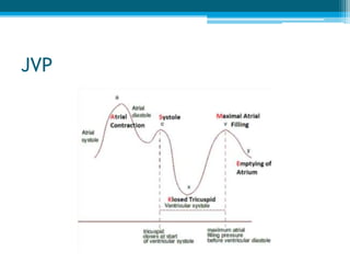JVP
 
