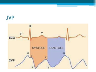 JVP
 