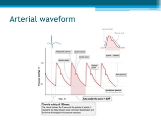Arterial waveform
 