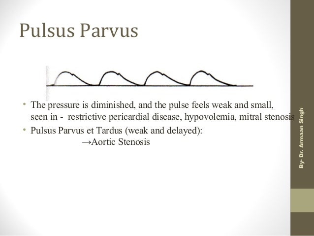 Cardiacphysiology&amp;anaestheticconsiderationscardiacoutput,pulse,bp,car…
