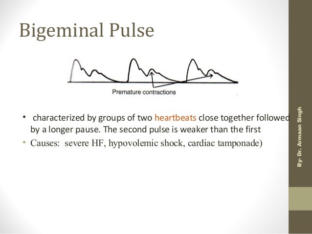 Pulse Pulse