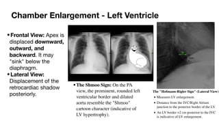 Aortic Shadow Comprehensive Interpretation of Cardiac Shadow on Chest X-Ray | PDF
