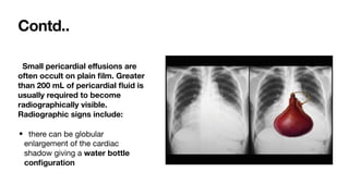 Comprehensive Interpretation of Cardiac Shadow on Chest X-Ray | PDF