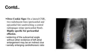 Comprehensive Interpretation of Cardiac Shadow on Chest X-Ray | PDF