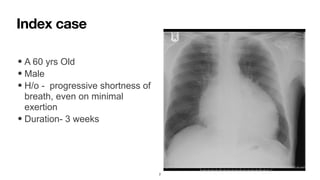 Comprehensive Interpretation of Cardiac Shadow on Chest X-Ray | PDF